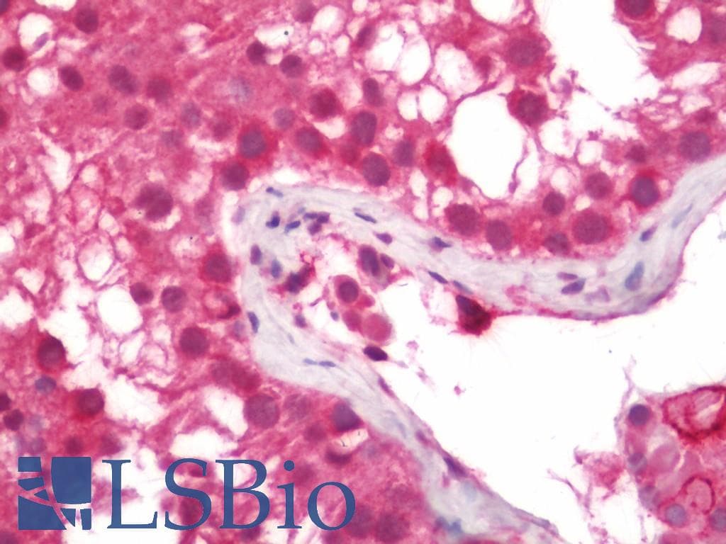 IHC-plus™ Polyclonal Rabbit anti-Human SEC63 Antibody (aa139-168, IHC, WB)