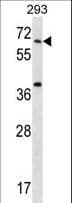 Polyclonal Rabbit anti-Human STXBP2 Antibody (aa440-469, WB)