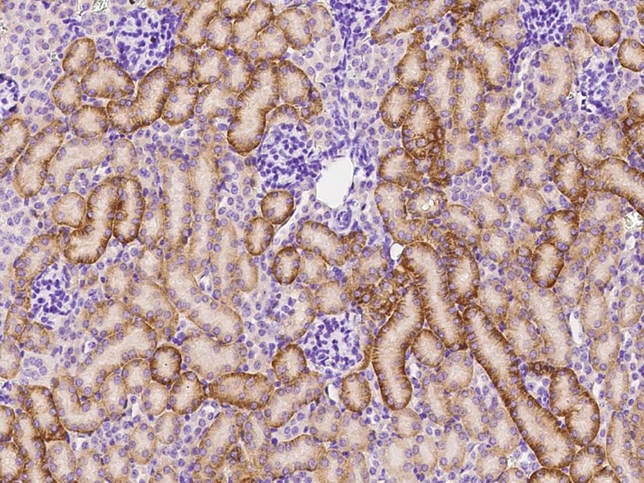Polyclonal Rabbit anti-Mouse STX6 / Syntaxin 6 Antibody (Preservative Free, IHC)