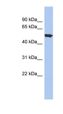 ACCN1 / ASIC2 Antibody (C-Terminus)
