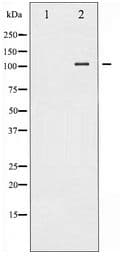 Polyclonal Rabbit anti-Human NFKB1 / NF-Kappa-B Antibody (IHC, IF, WB)