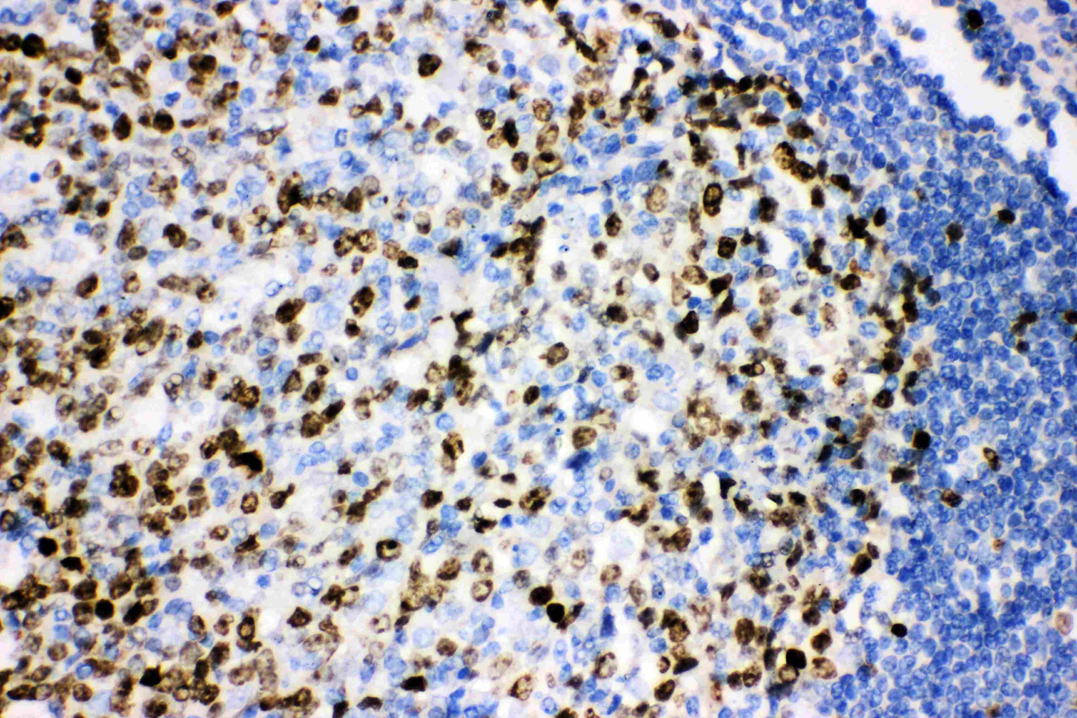 MKI67 / Ki67 Antibody (aa2860-3256)