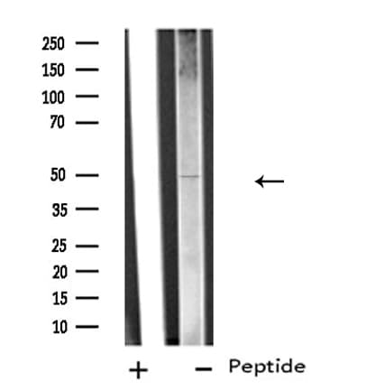 SLC38A2 / SNAT2 Antibody (aa173-192)