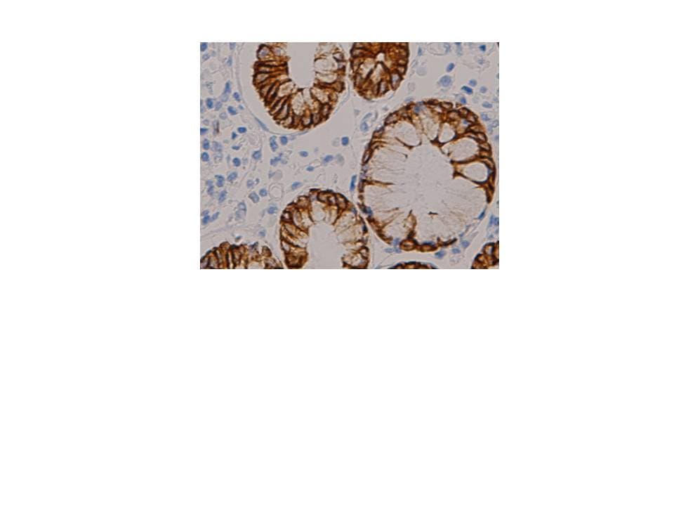 Monoclonal Mouse anti-Human KRT18 / CK18 / Cytokeratin 18 Antibody (IHC, WB)