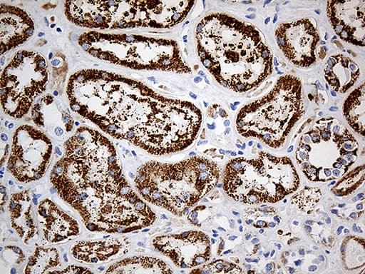 P5CDH / ALDH4A1 Antibody (aa1-503, clone OTI1H10)