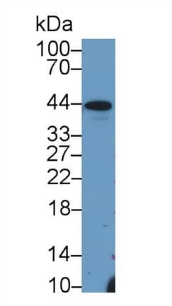 HP / Haptoglobin Antibody (aa118-281)