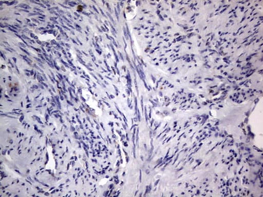PRX-1 / PRRX1 Antibody (clone OTI1E10)