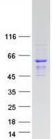 Human SAMD7 Protein (Recombinant Myc-DDK (Flag))