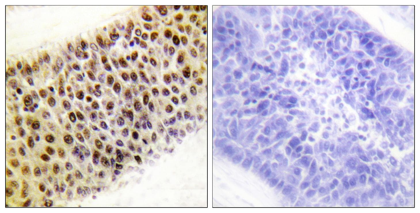 KAT5 / TIP60 Antibody (Ab-86)