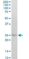APG5 / ATG5 Antibody (clone 1G11)