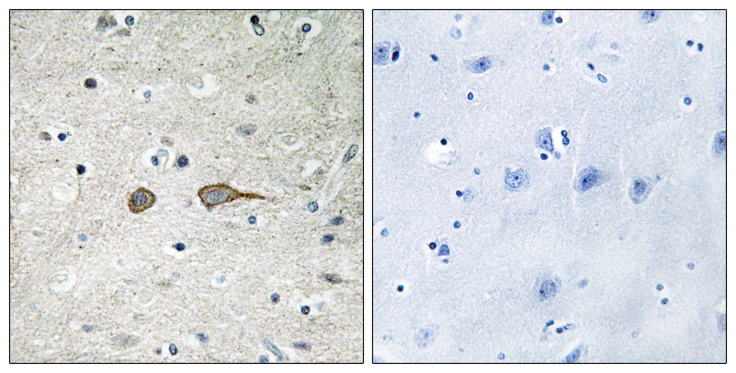 DENN / MADD Antibody (aa751-800)