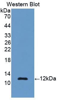 REN / Renin 1 Antibody (aa144-237)