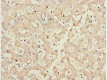 IWS1 Antibody