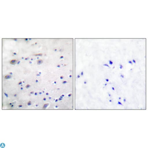 Polyclonal Rabbit anti-Human OPRM1 / Mu Opioid Receptor Antibody (IHC, WB)