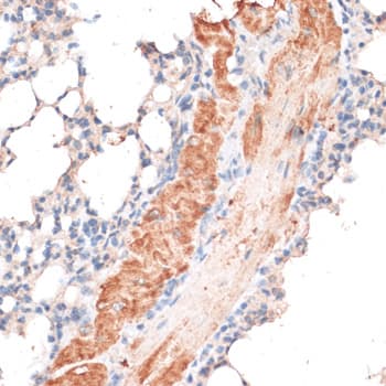 ABCB7 Antibody