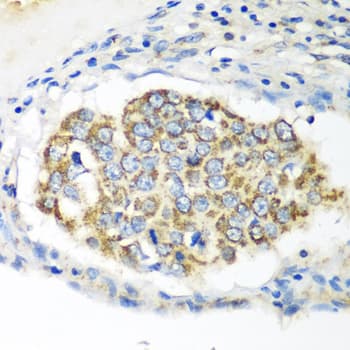 Polyclonal Rabbit anti-Human XIAP Antibody (IHC, IF, WB)