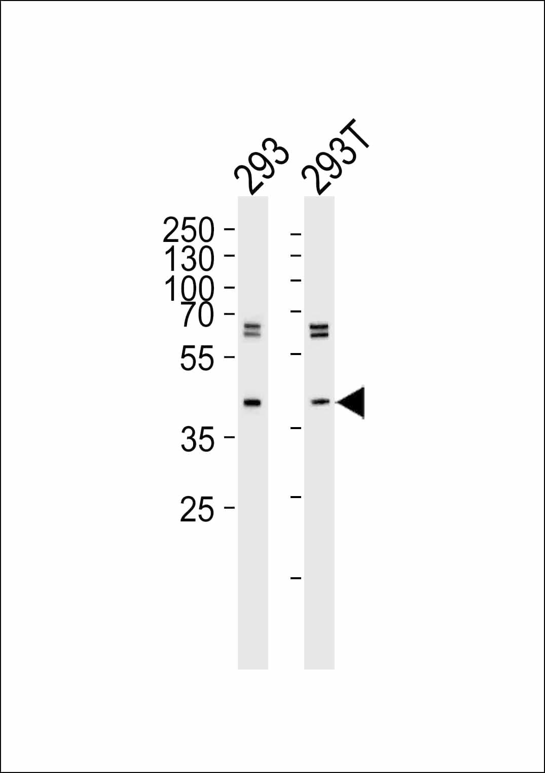 IHC-plus™ SETD8 / SET8 Antibody (N-Terminus, clone 43AT551.86)