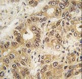 ZIC3 Antibody (aa4-32)