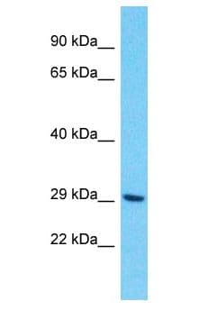 OR10H4 Antibody (aa181-230)