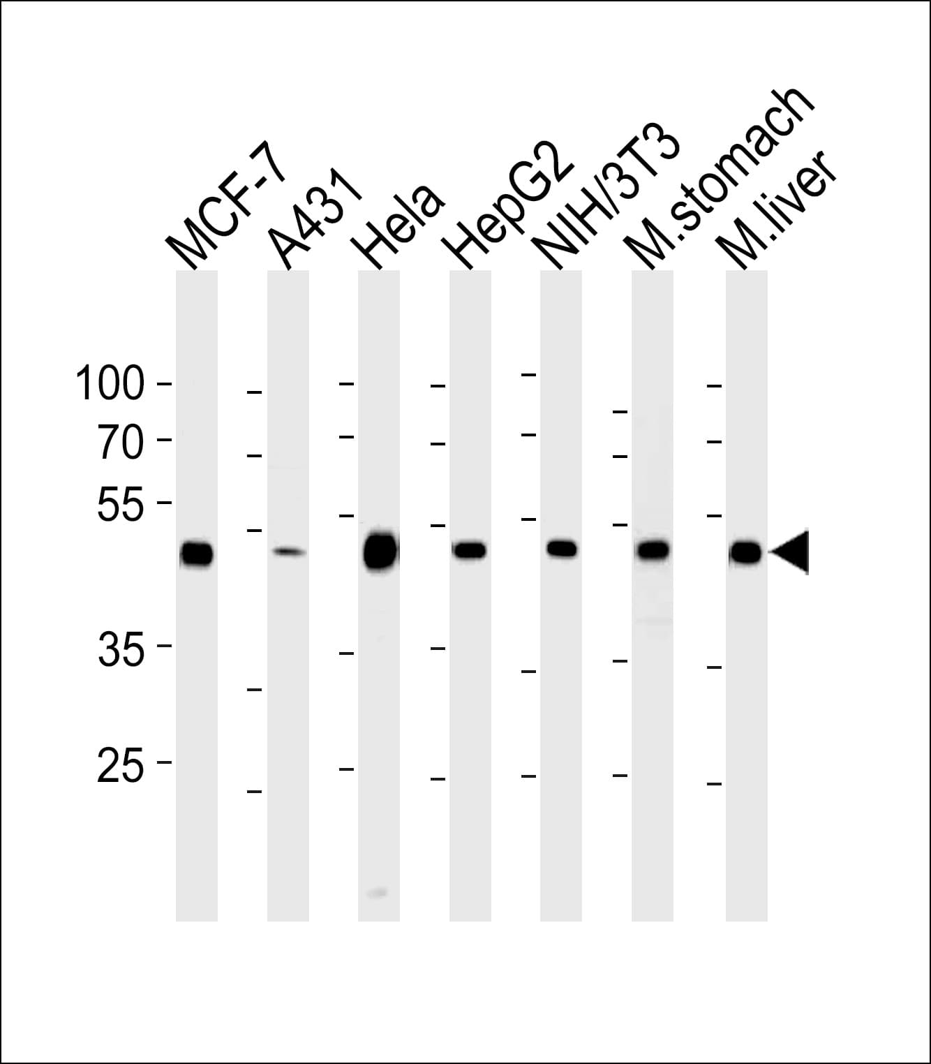 PathPlus™ Monoclonal Mouse anti-Human ENO1 / Alpha Enolase Antibody (clone 786CT6.6.4, IHC, WB)