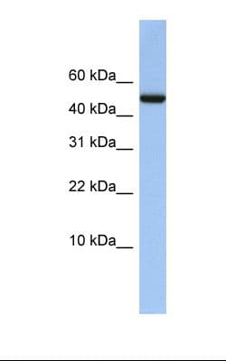 Polyclonal Rabbit anti-Human ABAT Antibody (aa290-339, IHC, WB)