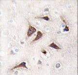 CAMK2D / CaMKII Delta Antibody (aa448-478)