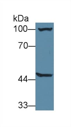 AGXT2 Antibody (PE)