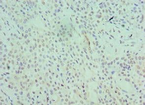 Polyclonal Rabbit anti-Human SRSF1 / SF2 Antibody (aa1-248, IHC)