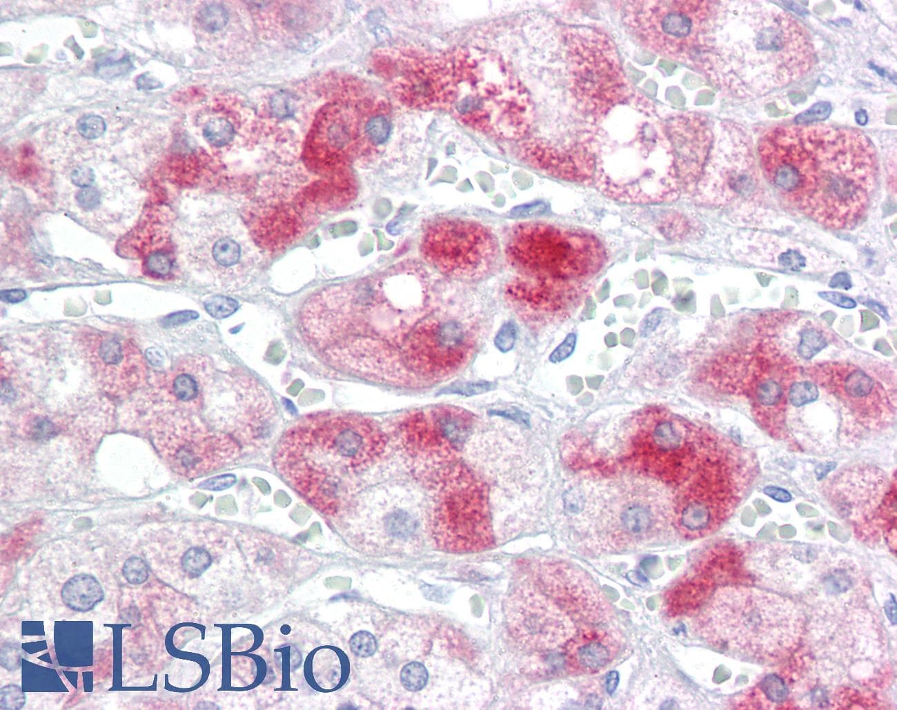 IHC-plus™ NPC / NPC1 Antibody