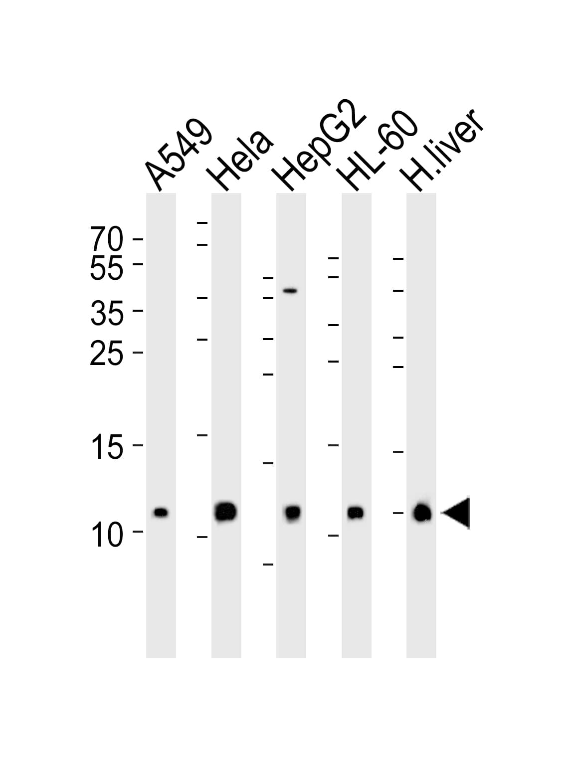 COXG / COX6B1 Antibody (aa8-22)