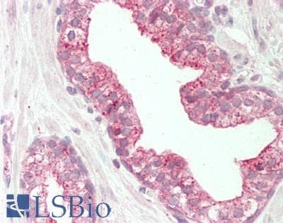 Polyclonal Rabbit anti-Human TSPAN1 / TM4SF Antibody (aa143-192, IHC, WB)