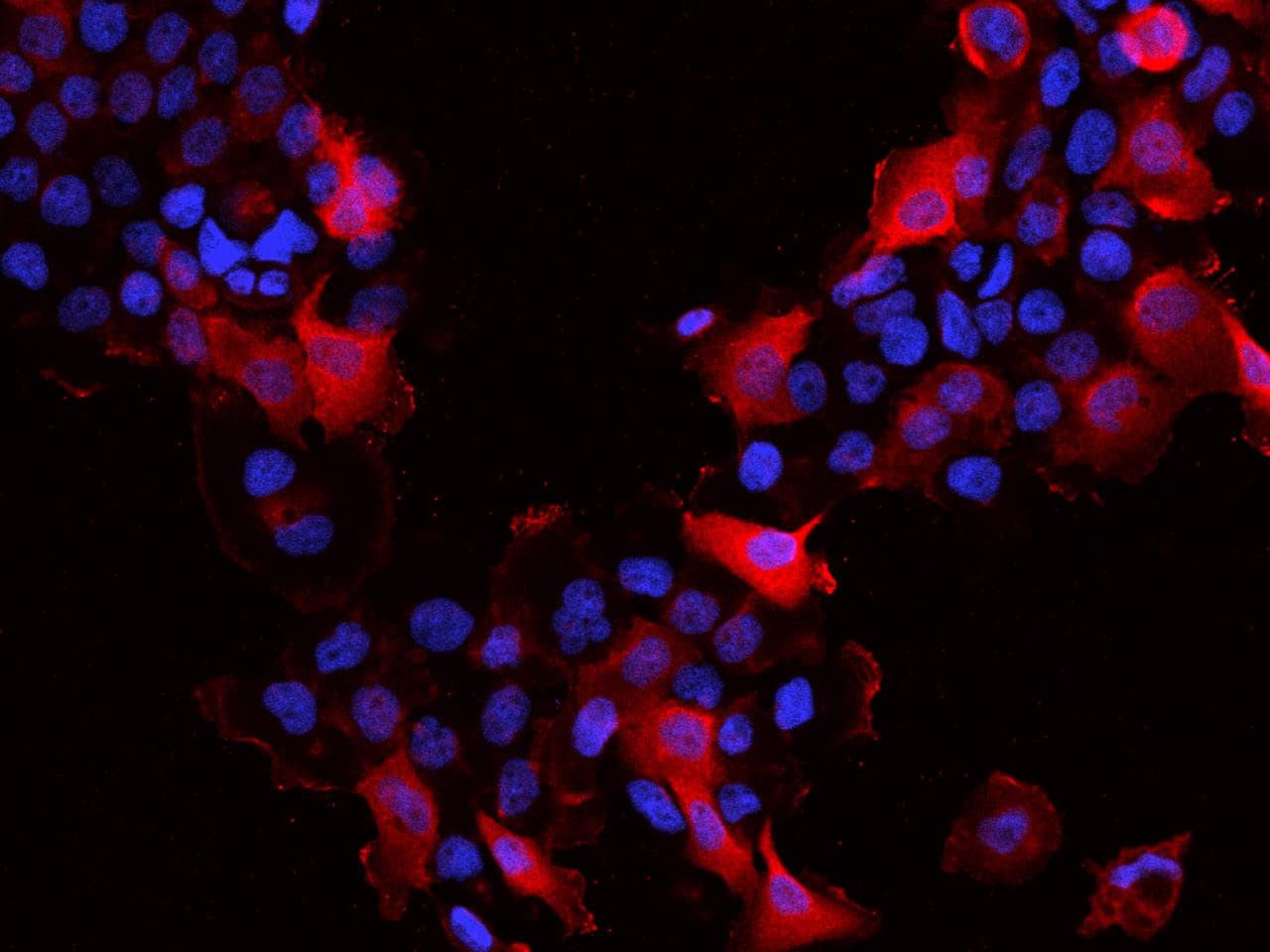 Polyclonal Rabbit anti-Human SLK Antibody (IF)