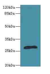 fabI Antibody (aa1-256)
