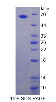 Human GABRA2 Protein (Recombinant His-GST, N-terminus)