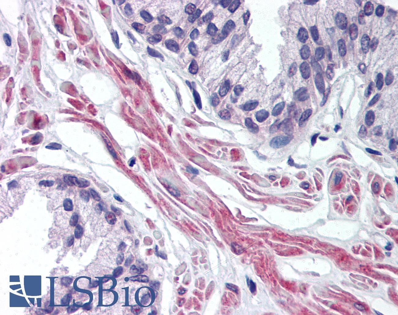 IHC-plus™ PTAR2 / FNTA Antibody (aa150-250)