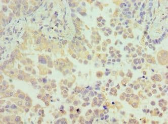 IHC-plus™ N6AMT1 Antibody (aa1-186)