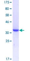 Human ENPP3 / CD203c Protein (Recombinant GST, N-terminus)