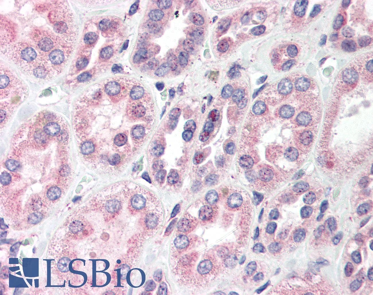 IHC-plus™ Polyclonal Rabbit anti-Human POLM / DNA Polymerase Mu Antibody (IHC, WB)