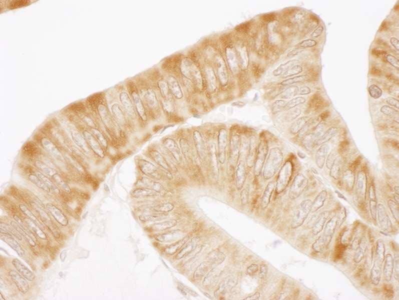Polyclonal Rabbit anti-Human ARHGEF5 Antibody (aa600-650, IHC, IF)