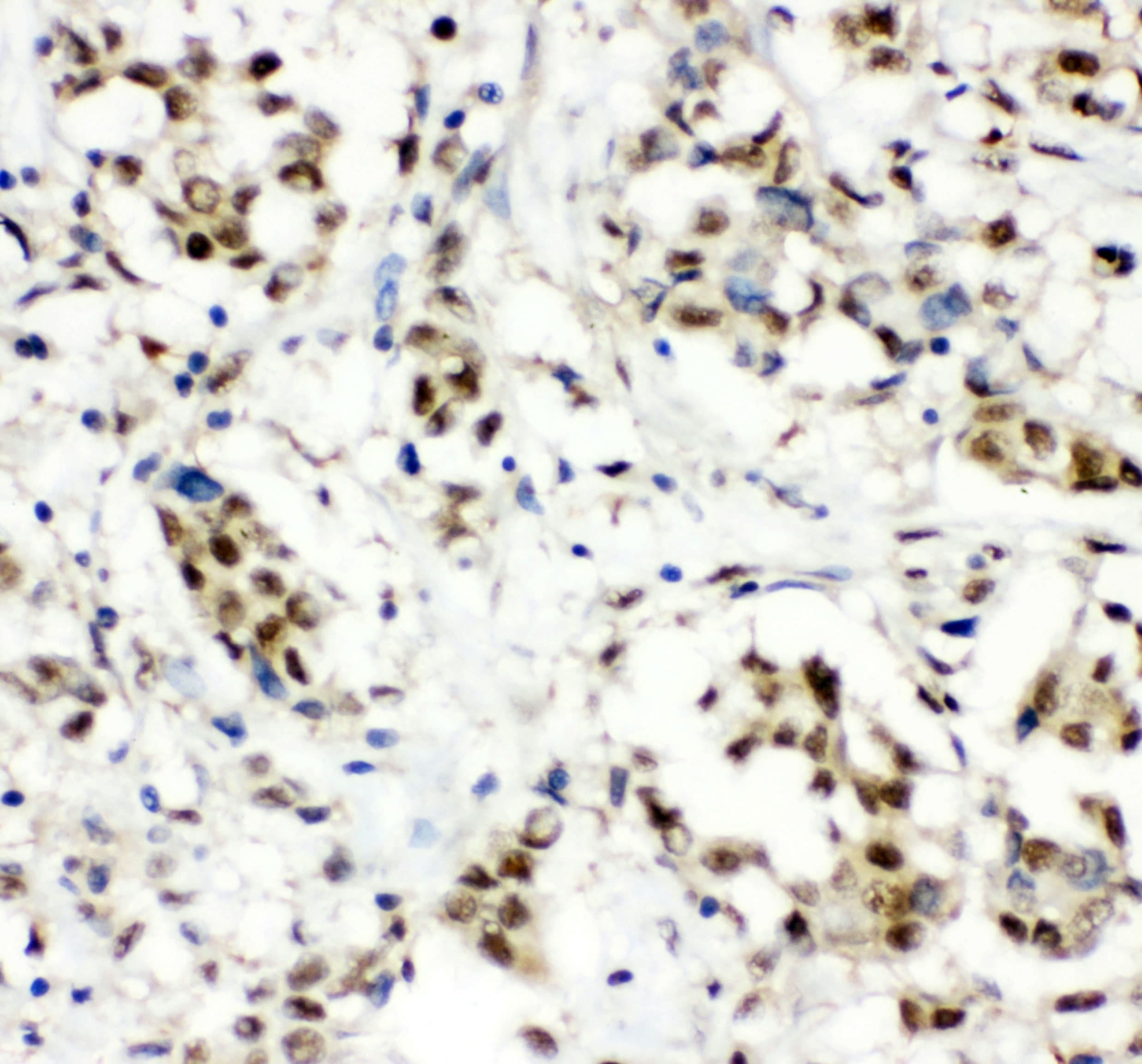 Polyclonal Rabbit anti-Human CCT3 Antibody (IHC, WB)