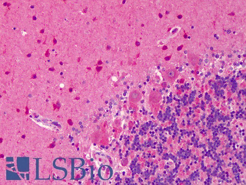 PathPlus™ NOS1 / nNOS Antibody (aa1422-1433)
