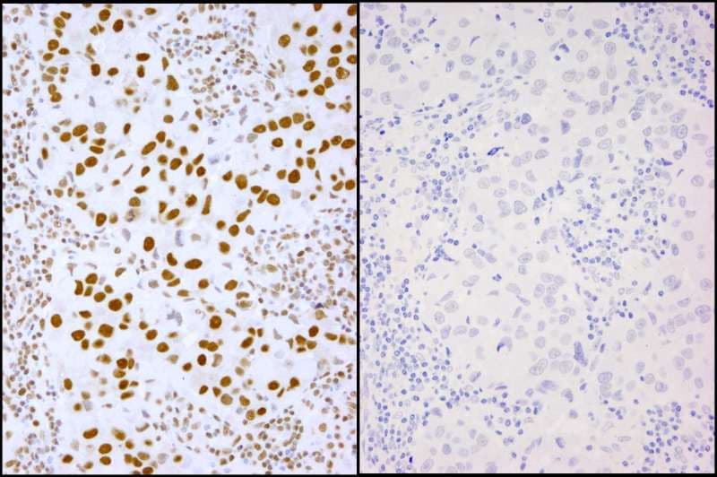 XRCC1 Antibody (phospho-Ser485 / pThr488)