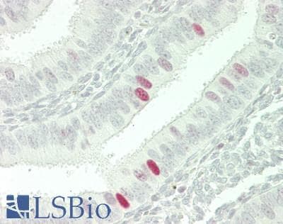 IHC-plus™ XRCC6 / Ku70 Antibody (N-Terminus)