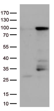 EWSR1 / EWS Antibody (aa256-447, clone OTI2D9, Carrier-free)