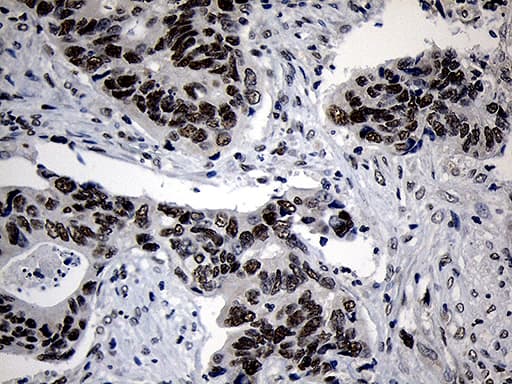 Monoclonal Mouse anti-Human ZNF670 Antibody (clone OTI6E10, IHC, WB)