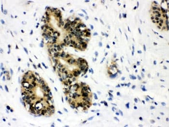 Polyclonal Rabbit anti-Human COPS5 / JAB1 Antibody (IHC, WB)