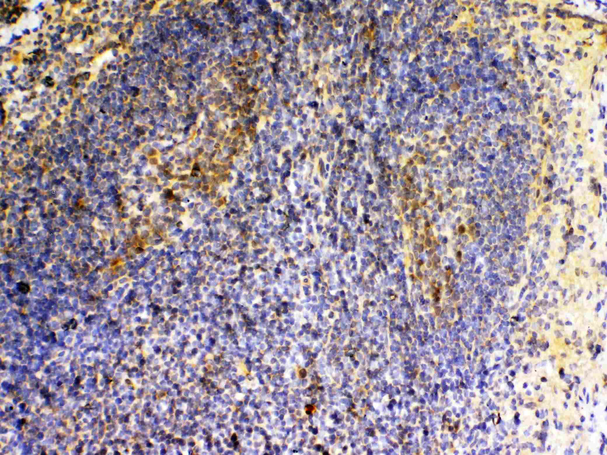 VEGFB Antibody