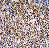 Polyclonal Rabbit anti-Human KIR3DL3 / CD158z Antibody (aa132-158, IHC, WB)