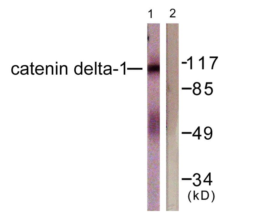 CTNND1 / p120 Catenin Antibody (p228)