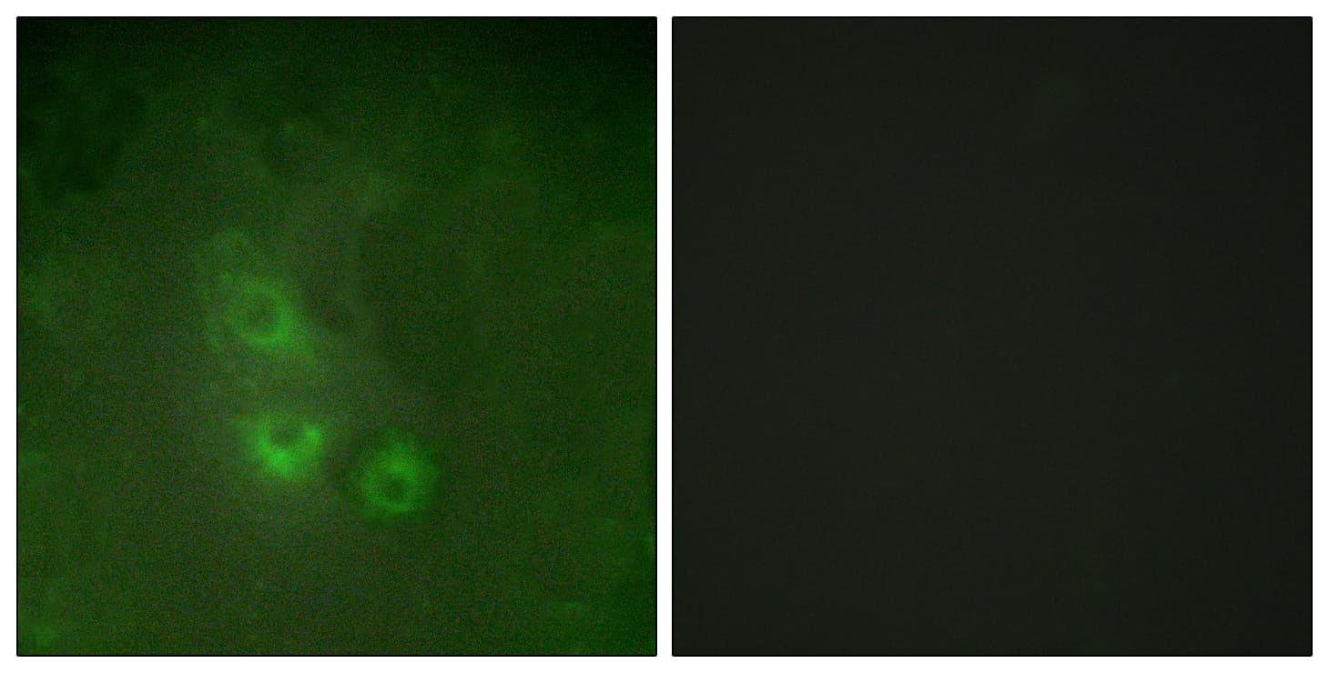 FRK Antibody (aa71-120)